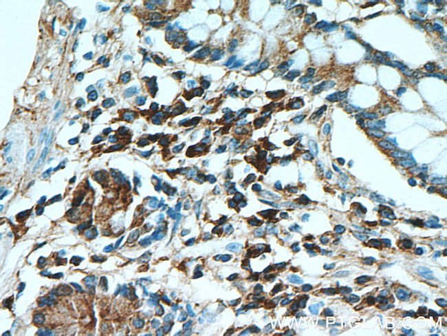 Human IgA Antibody in Immunohistochemistry (Paraffin) (IHC (P))