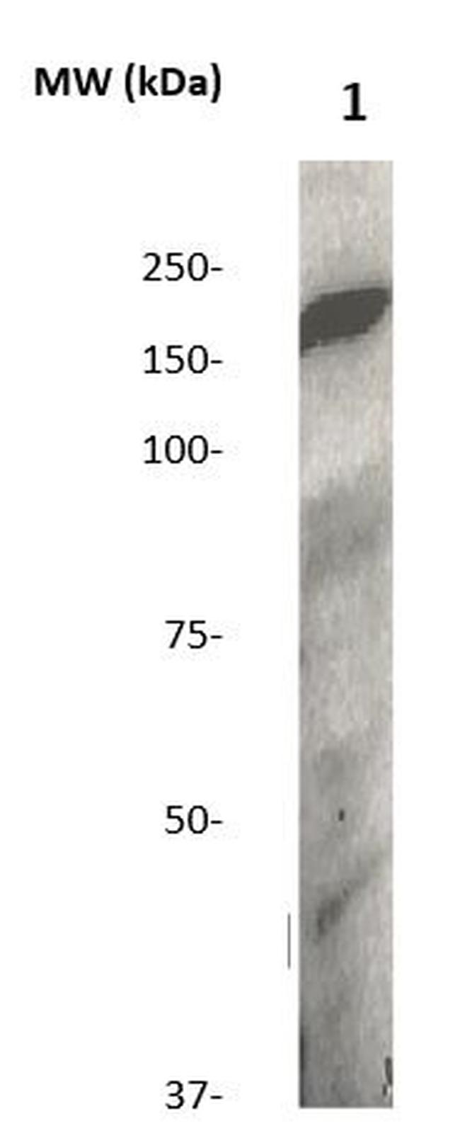 Phospho-LRP5 (Thr1492) Antibody in Western Blot (WB)