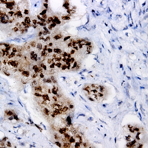 Phospho-LRP6 (Thr1479) Antibody in Immunohistochemistry (Paraffin) (IHC (P))