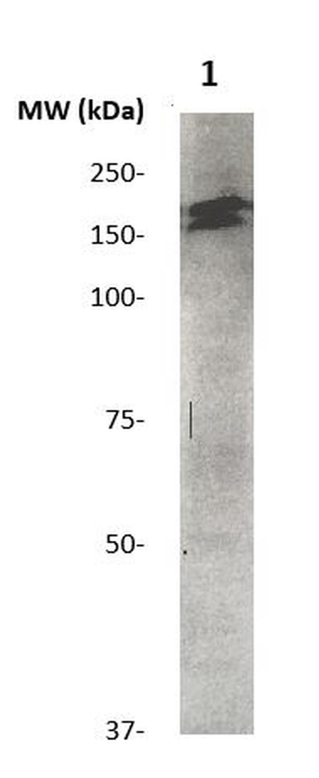 Phospho-LRP6 (Thr1479) Antibody in Western Blot (WB)