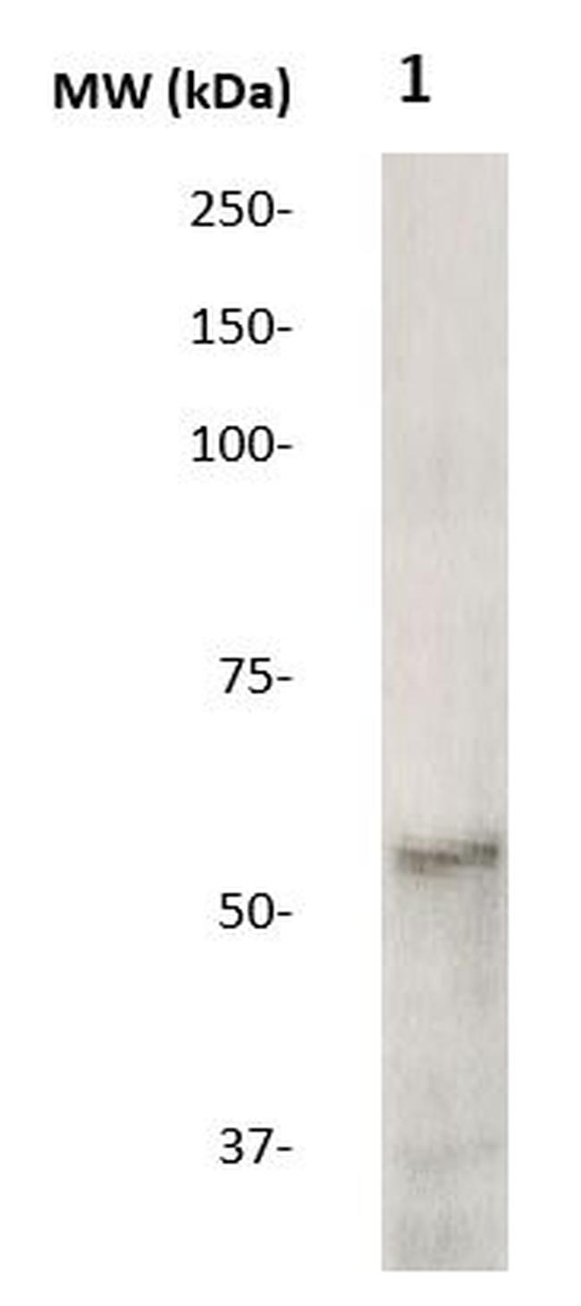 H1N1 (Influenza A virus) Antibody in Western Blot (WB)