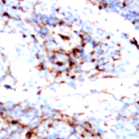 MMP-12 Antibody in Immunohistochemistry (Paraffin) (IHC (P))