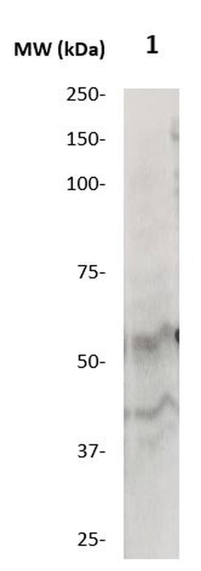 MMP-20 Antibody in Western Blot (WB)