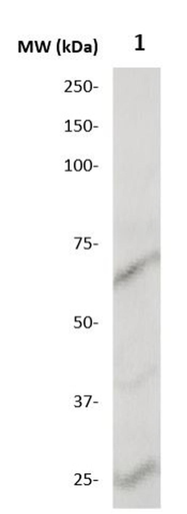 MMP-21 Antibody in Western Blot (WB)