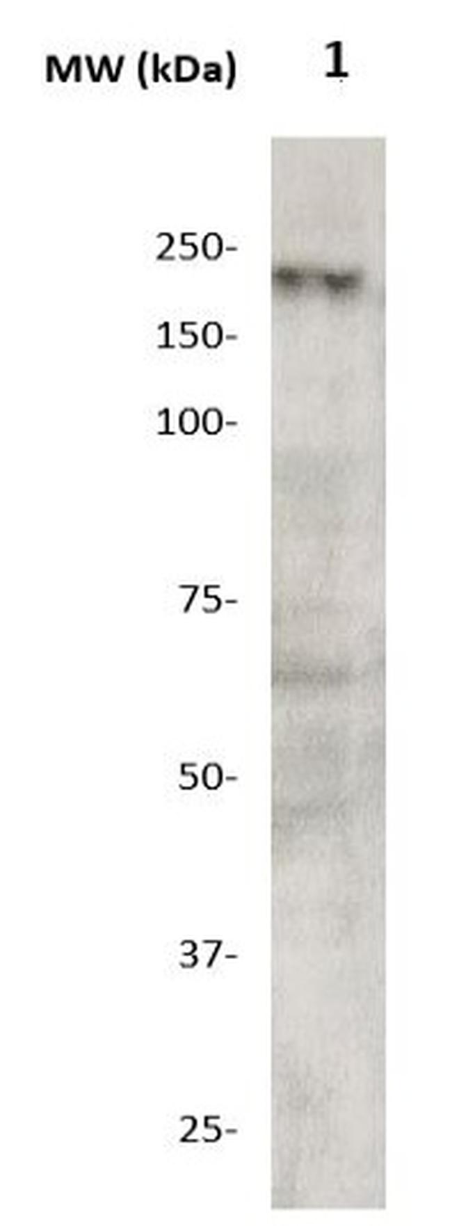 DCC Antibody in Western Blot (WB)