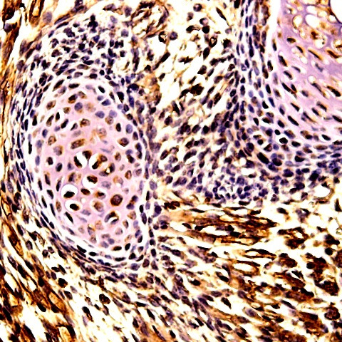 SOX-1 Antibody in Immunohistochemistry (Paraffin) (IHC (P))