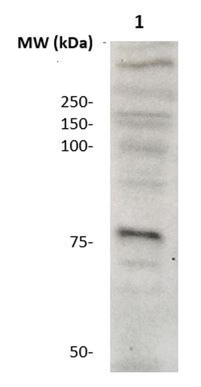 Coagulation Factor VIII (Cleaved form, C-Term) Antibody in Western Blot (WB)