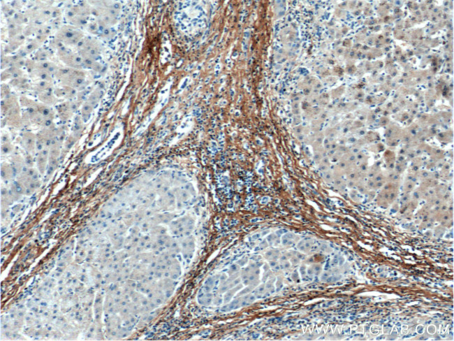 Fibromodulin Antibody in Immunohistochemistry (Paraffin) (IHC (P))