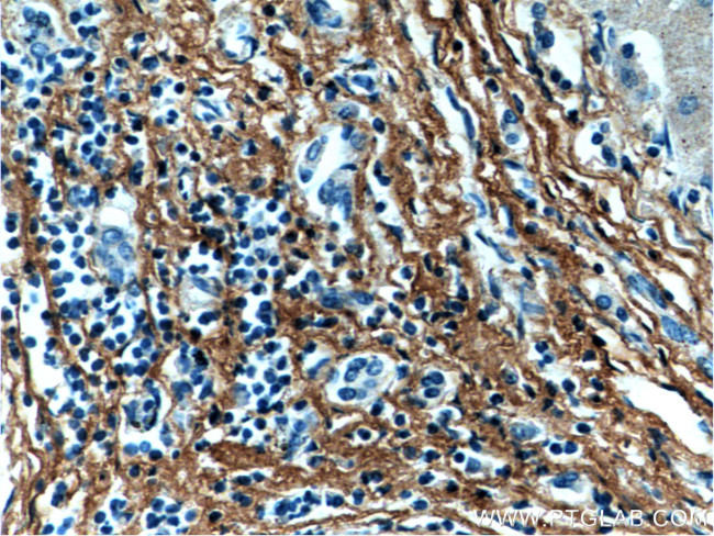 Fibromodulin Antibody in Immunohistochemistry (Paraffin) (IHC (P))