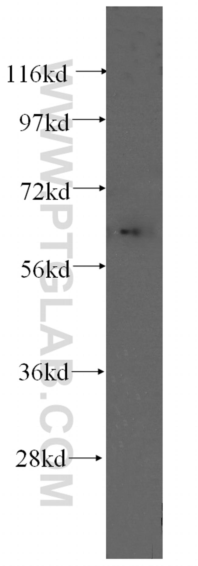 Fibromodulin Antibody in Western Blot (WB)