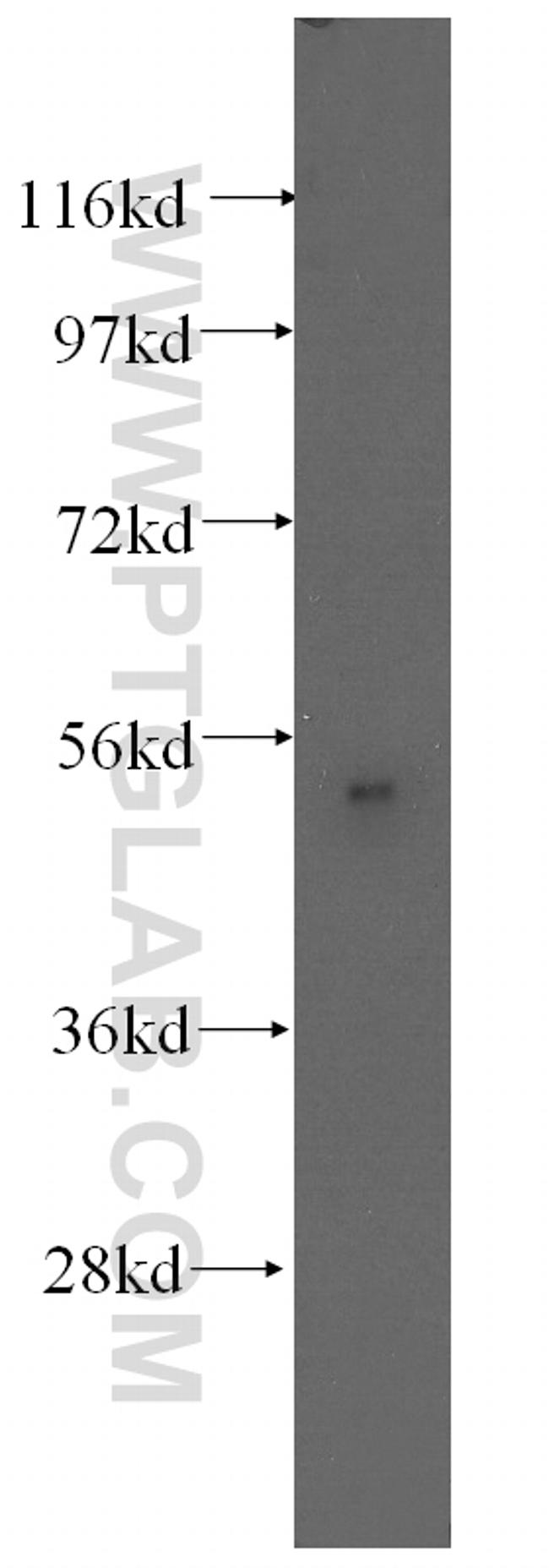 Fibromodulin Antibody in Western Blot (WB)