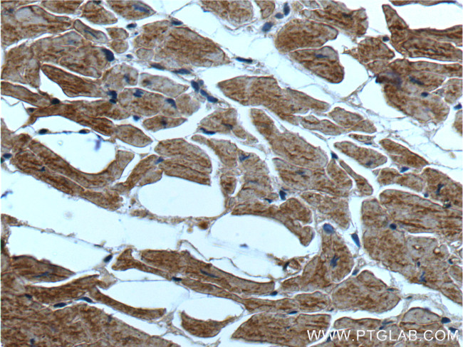 ST2 Antibody in Immunohistochemistry (Paraffin) (IHC (P))