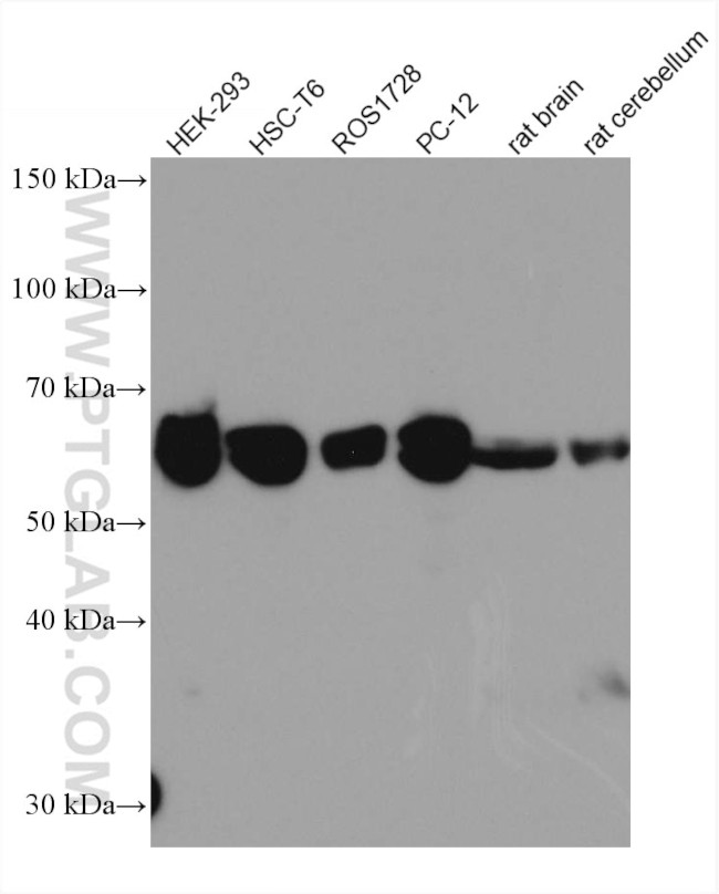 ST2 Antibody in Western Blot (WB)