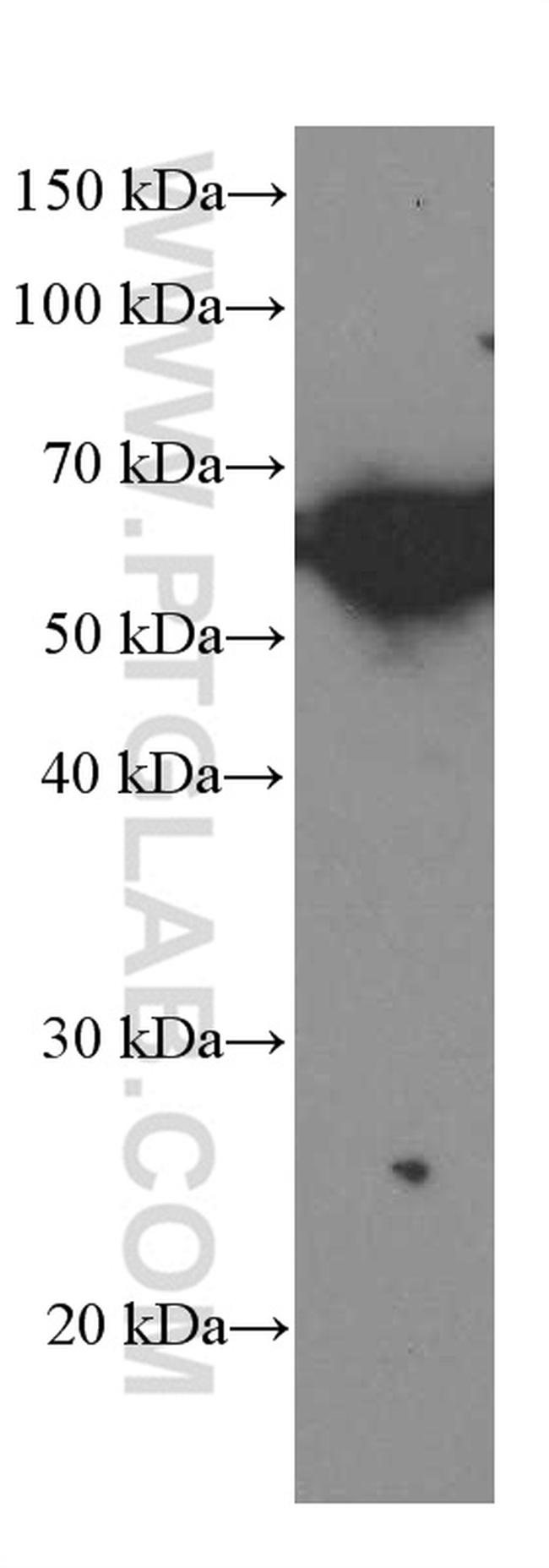 ST2 Antibody in Western Blot (WB)