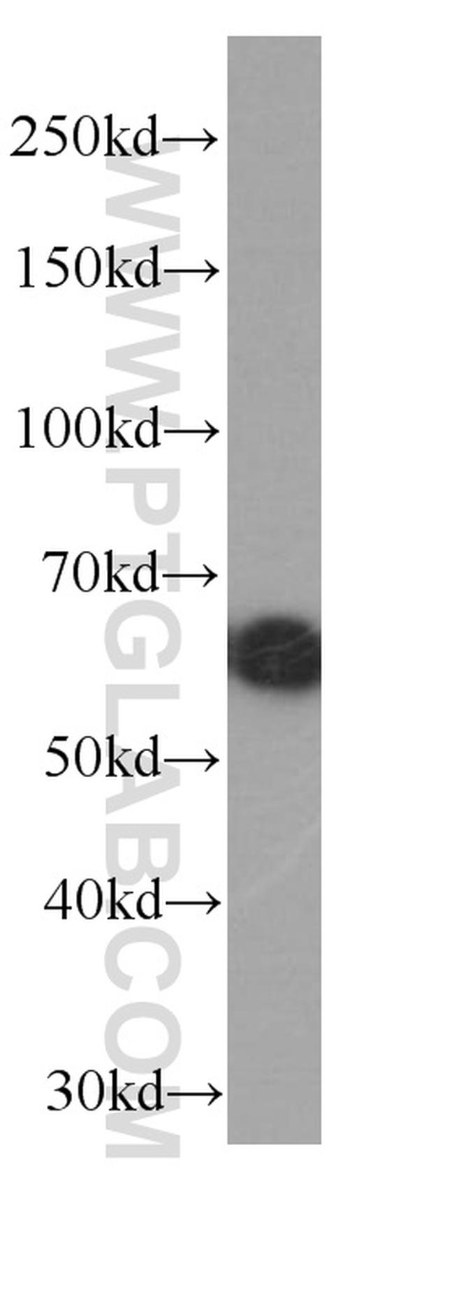 ST2 Antibody in Western Blot (WB)