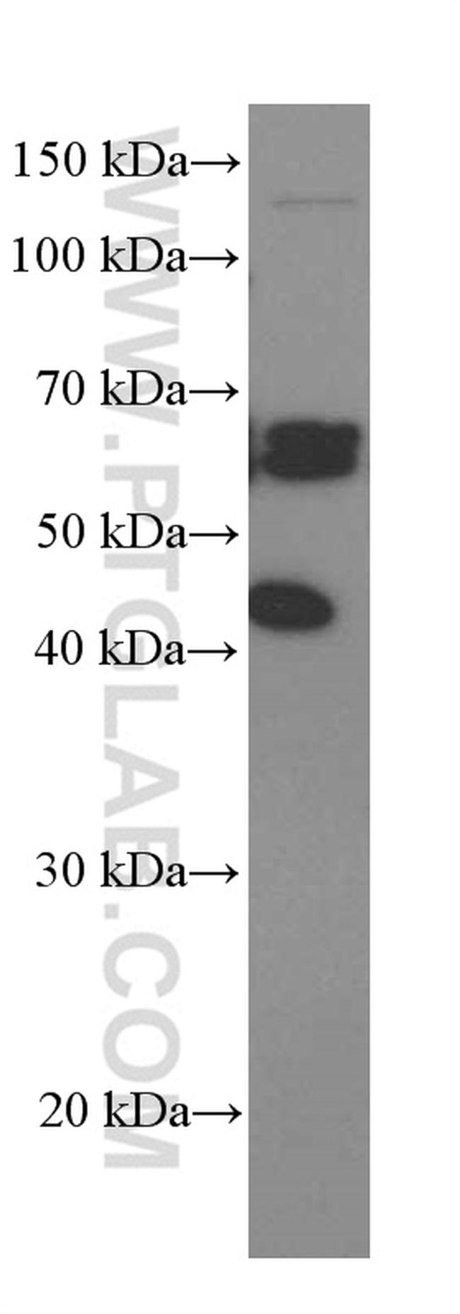 ST2 Antibody in Western Blot (WB)