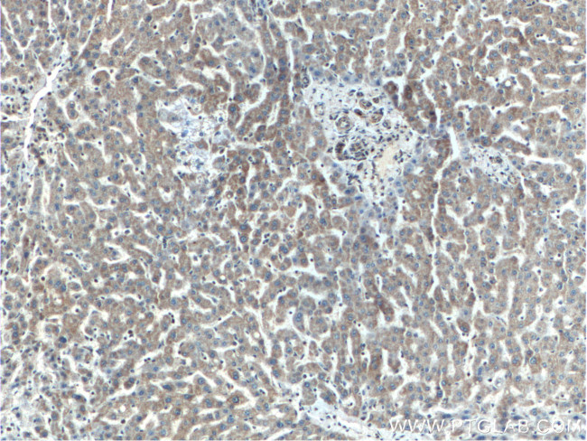 SERPINA10 Antibody in Immunohistochemistry (Paraffin) (IHC (P))