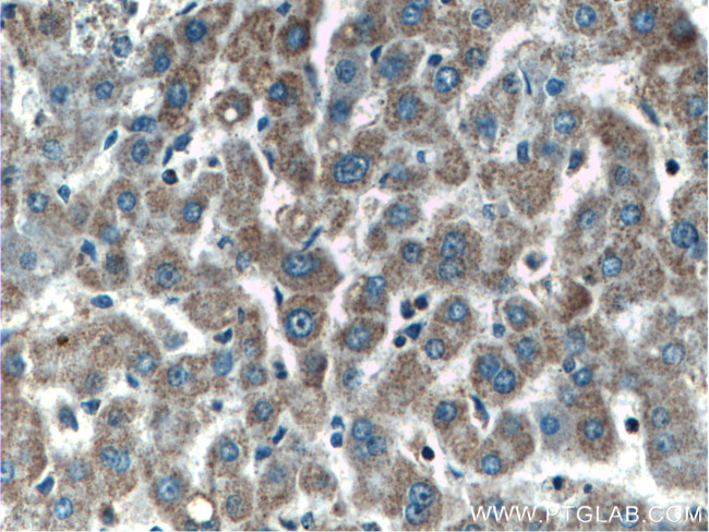 SERPINA10 Antibody in Immunohistochemistry (Paraffin) (IHC (P))