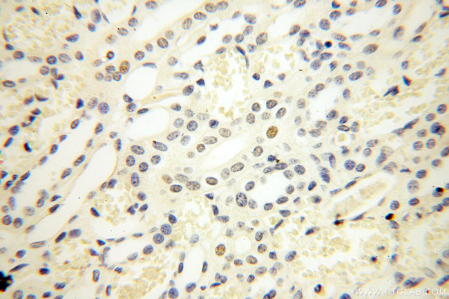 NR2F6 Antibody in Immunohistochemistry (Paraffin) (IHC (P))