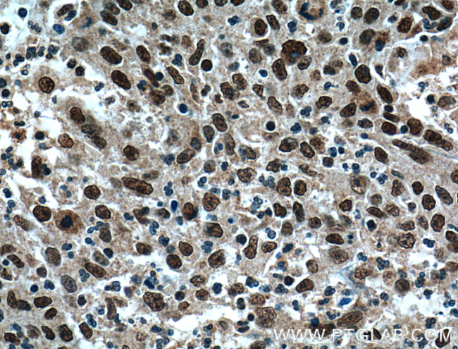 BRD8 Antibody in Immunohistochemistry (Paraffin) (IHC (P))