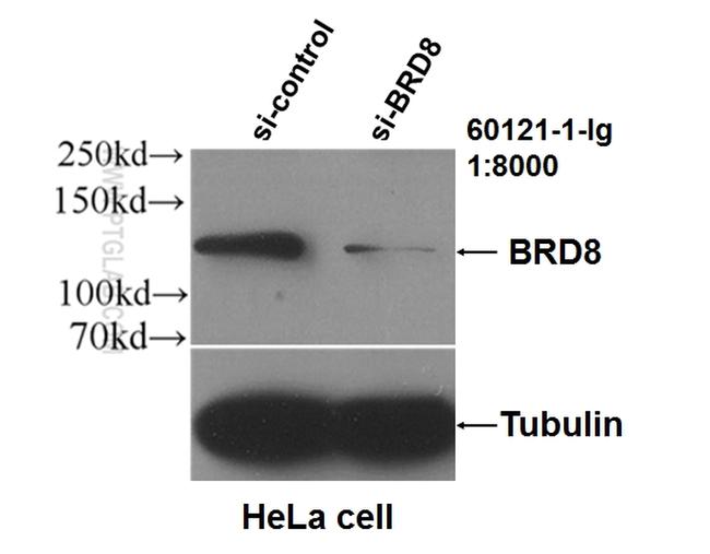 BRD8 Antibody in Western Blot (WB)