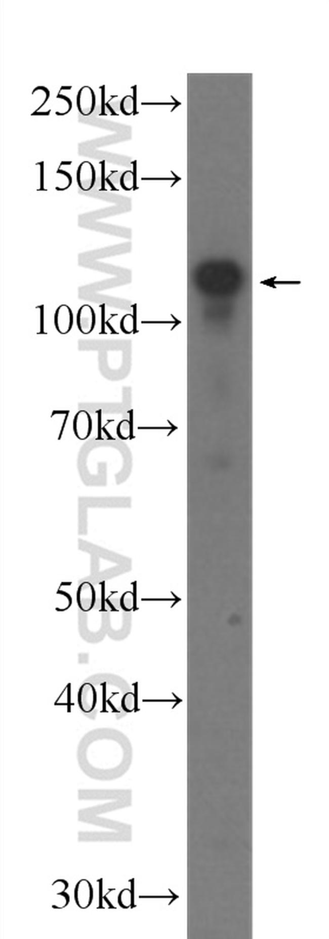 BRD8 Antibody in Western Blot (WB)