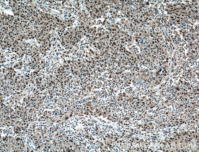 BRD8 Antibody in Immunohistochemistry (Paraffin) (IHC (P))