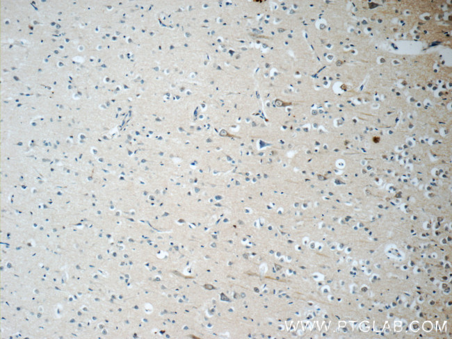 KCNMB4 Antibody in Immunohistochemistry (Paraffin) (IHC (P))