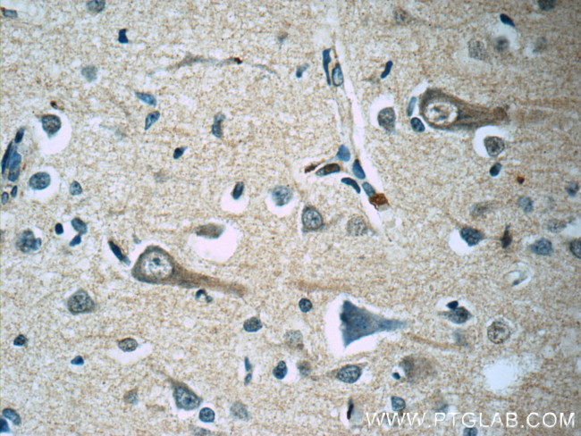 KCNMB4 Antibody in Immunohistochemistry (Paraffin) (IHC (P))