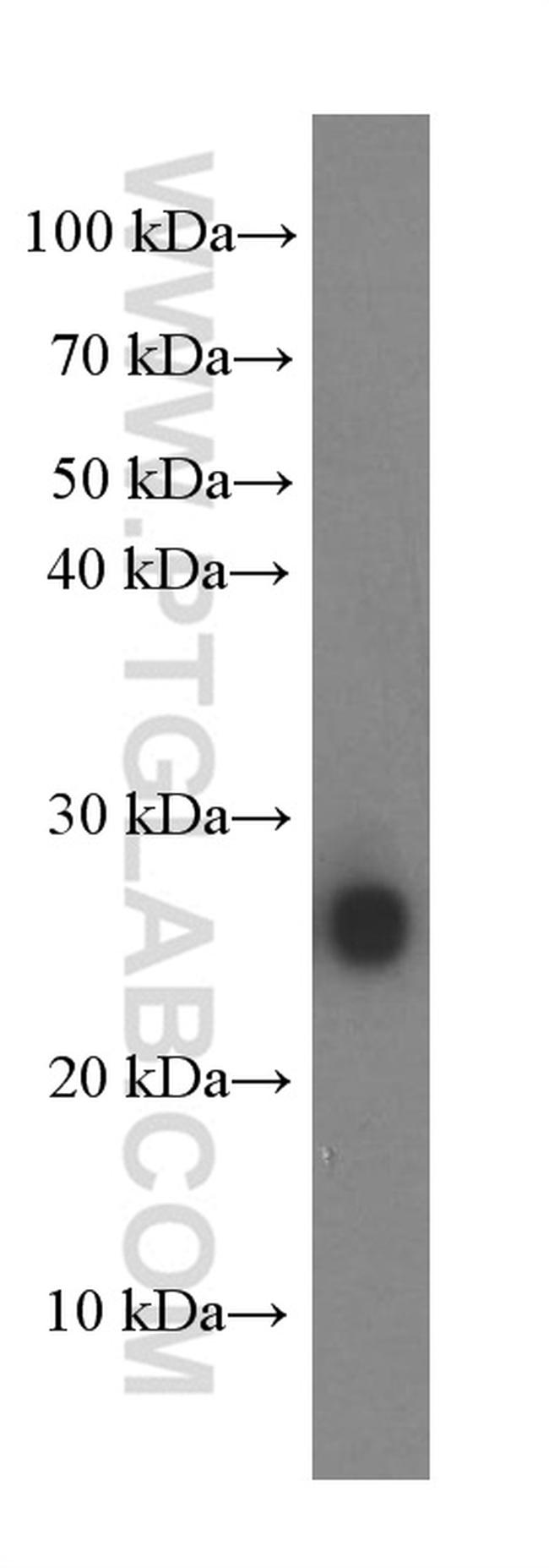 KCNMB4 Antibody in Western Blot (WB)