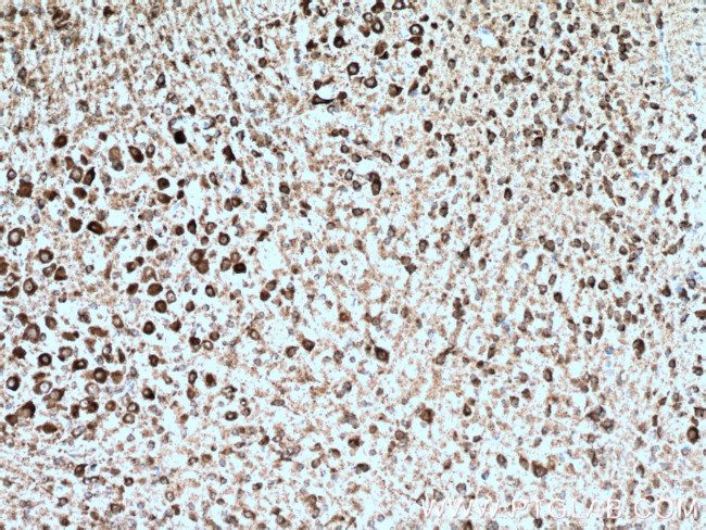 KCNMB4 Antibody in Immunohistochemistry (Paraffin) (IHC (P))