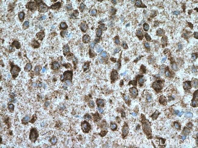 KCNMB4 Antibody in Immunohistochemistry (Paraffin) (IHC (P))