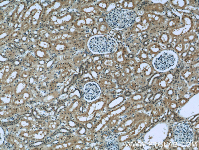 RENALASE Antibody in Immunohistochemistry (Paraffin) (IHC (P))