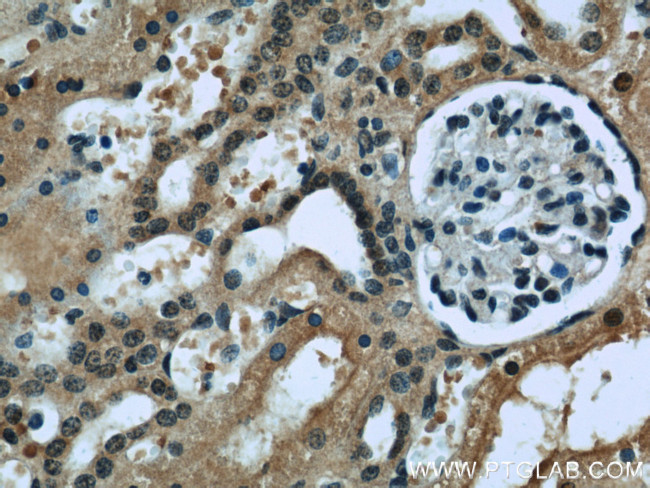 RENALASE Antibody in Immunohistochemistry (Paraffin) (IHC (P))