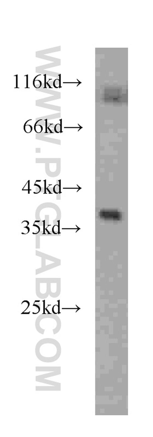 RENALASE Antibody in Western Blot (WB)