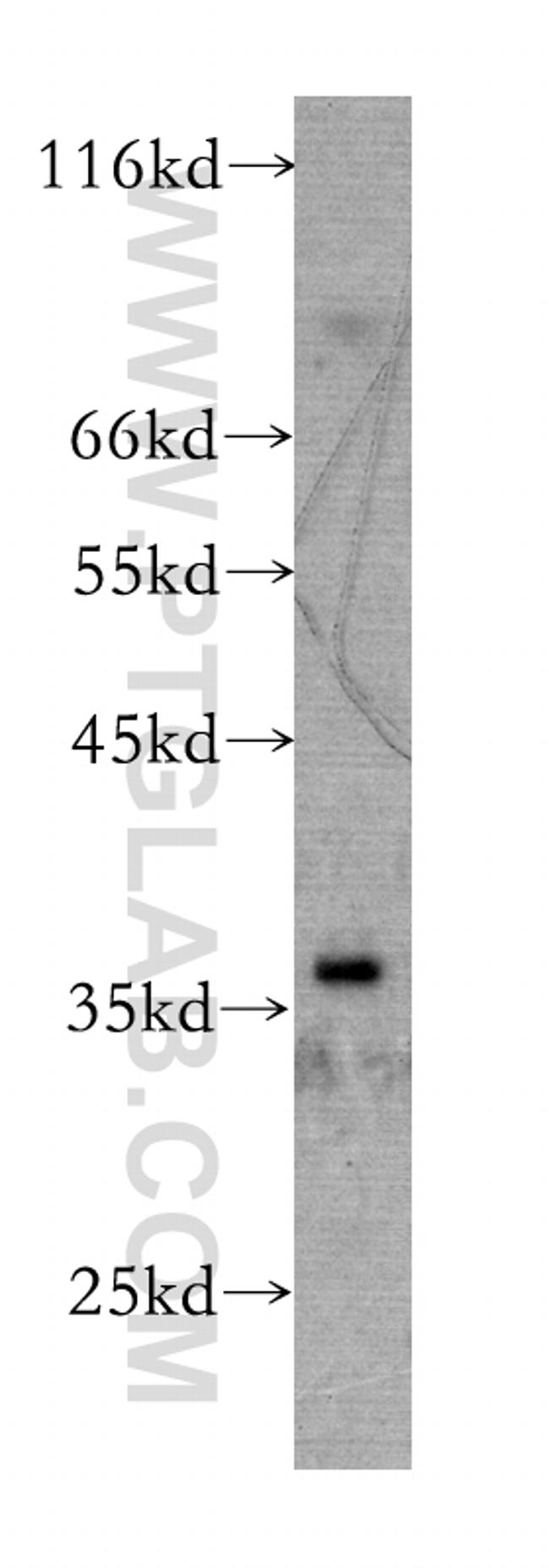 RENALASE Antibody in Western Blot (WB)