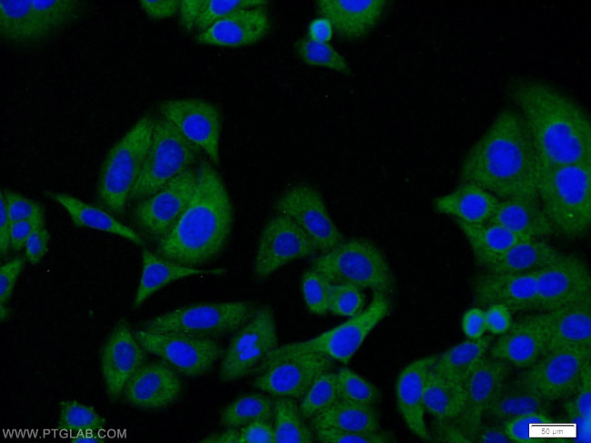 NR1H3 Antibody in Immunocytochemistry (ICC/IF)