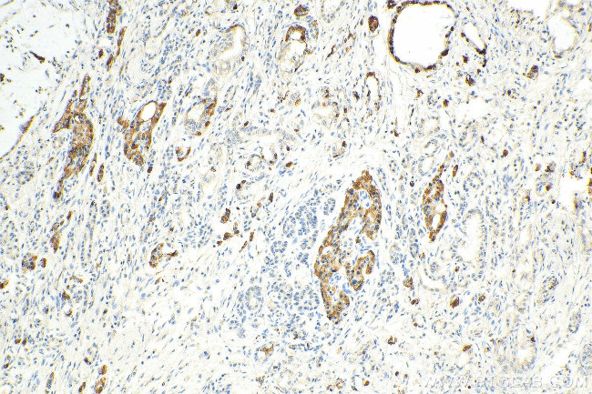 Chromogranin A Antibody in Immunohistochemistry (Paraffin) (IHC (P))