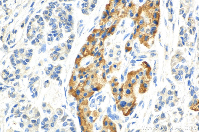 Chromogranin A Antibody in Immunohistochemistry (Paraffin) (IHC (P))