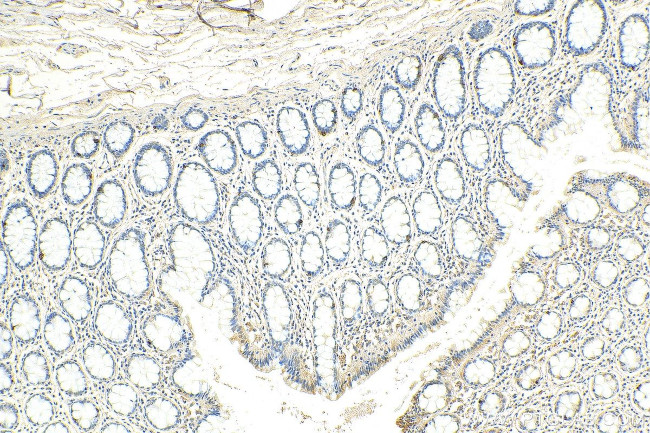 Chromogranin A Antibody in Immunohistochemistry (Paraffin) (IHC (P))