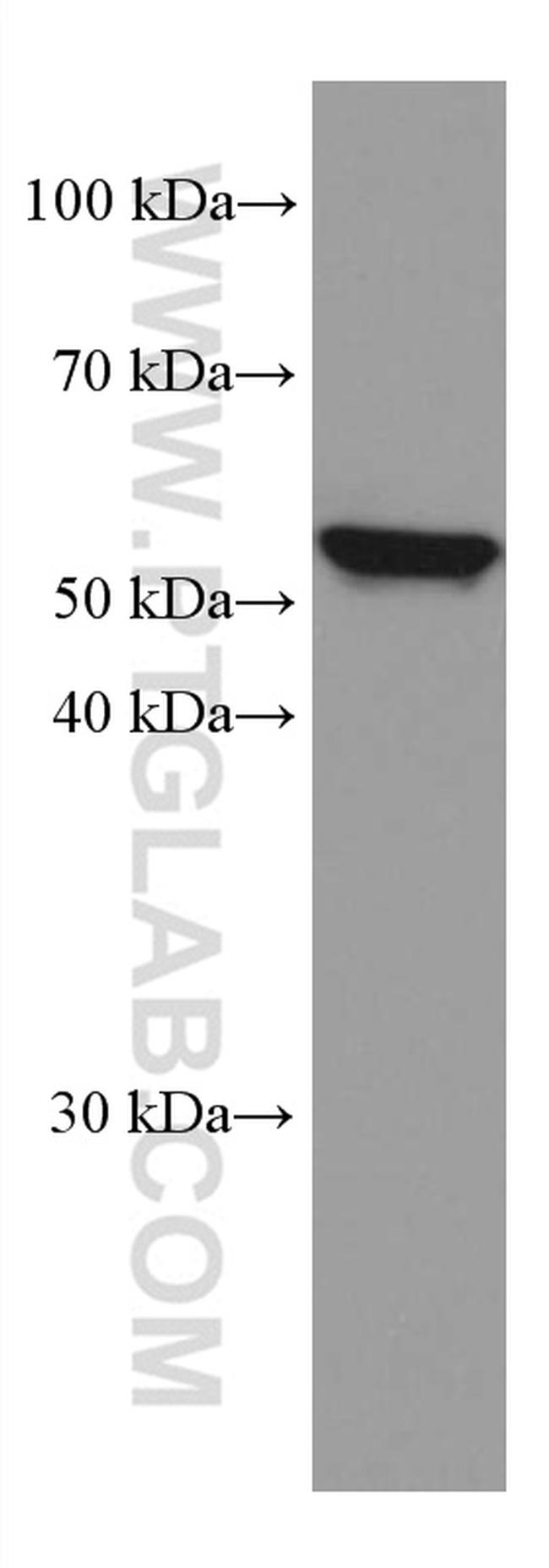 IL-15RA Antibody in Western Blot (WB)