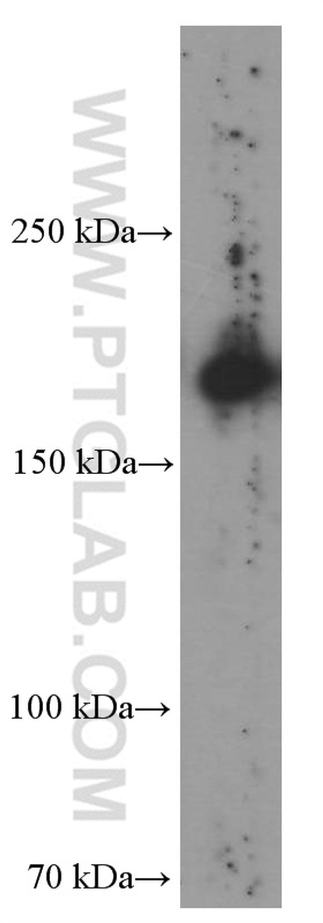 CD206 Antibody in Western Blot (WB)