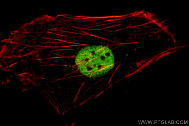 PAX8 Antibody in Immunocytochemistry (ICC/IF)