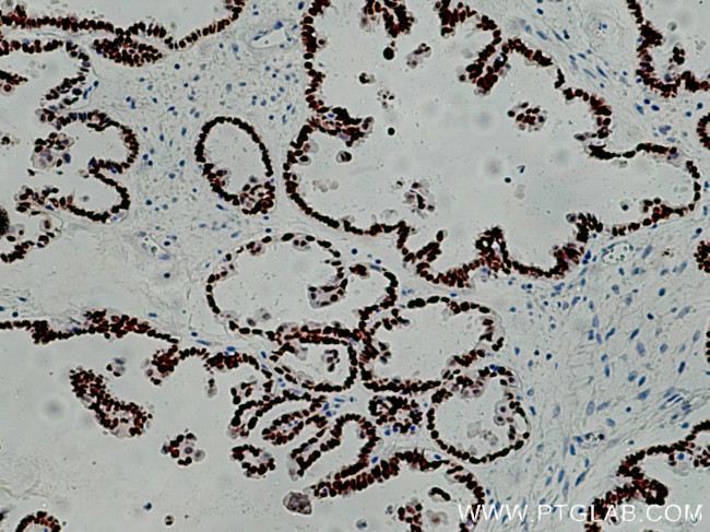 PAX8 Antibody in Immunohistochemistry (Paraffin) (IHC (P))