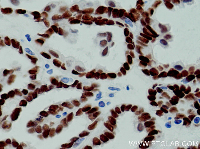 PAX8 Antibody in Immunohistochemistry (Paraffin) (IHC (P))