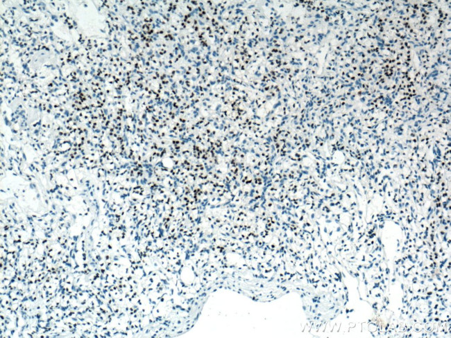 PAX8 Antibody in Immunohistochemistry (Paraffin) (IHC (P))