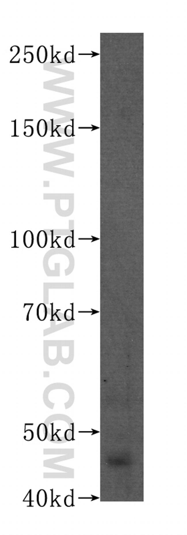 PAX8 Antibody in Western Blot (WB)