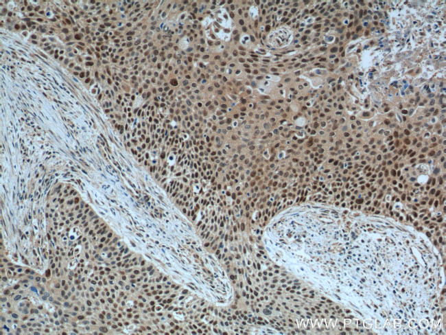 GSTO1 Antibody in Immunohistochemistry (Paraffin) (IHC (P))