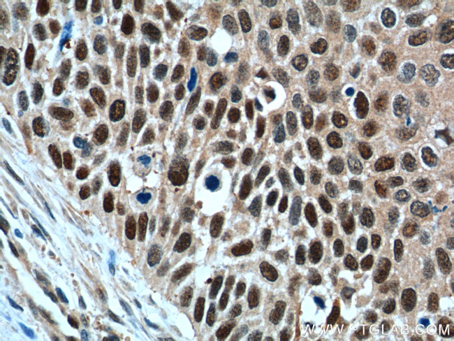 GSTO1 Antibody in Immunohistochemistry (Paraffin) (IHC (P))