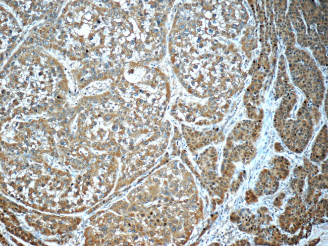 GSTO1 Antibody in Immunohistochemistry (Paraffin) (IHC (P))